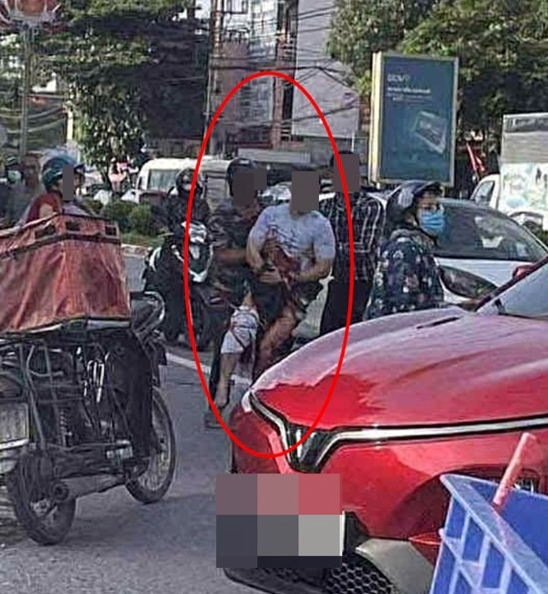 Tiktoker có tiếng ở Thái Nguyên bị chém đứt bàn tay trên đường