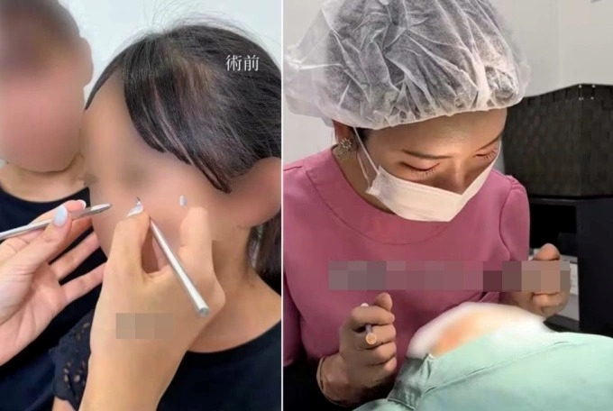 Thẩm mỹ viện gây tranh cãi vì dao kéo cho bé gái 10 tuổi