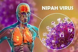 Virus Nipah là tác nhân truyền nhiễm nguy hiểm, tỉ lệ tử vong cao