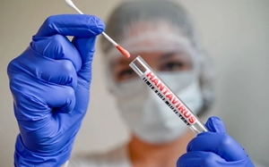 Tại sao dịch virus Hanta khác COVID-19